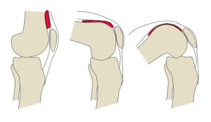 patella knee bend